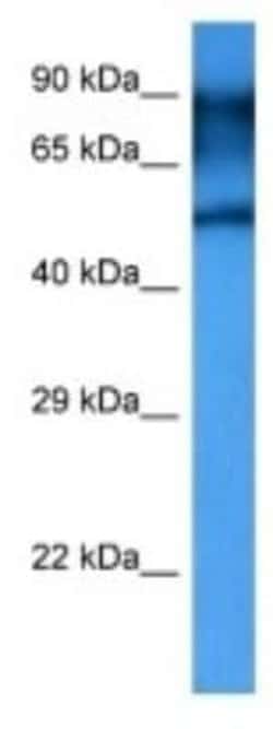Dopamine D5R/DRD5 Rabbit anti-Human, Polyclonal, Novus Biologicals 100